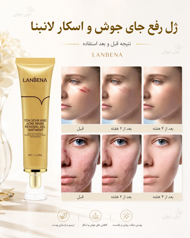 کرم ترمیم کننده پوسک لک جوش